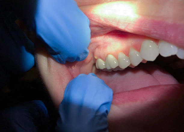 Best Walk-In Emergency Dentist in Jamaica Beach, TX